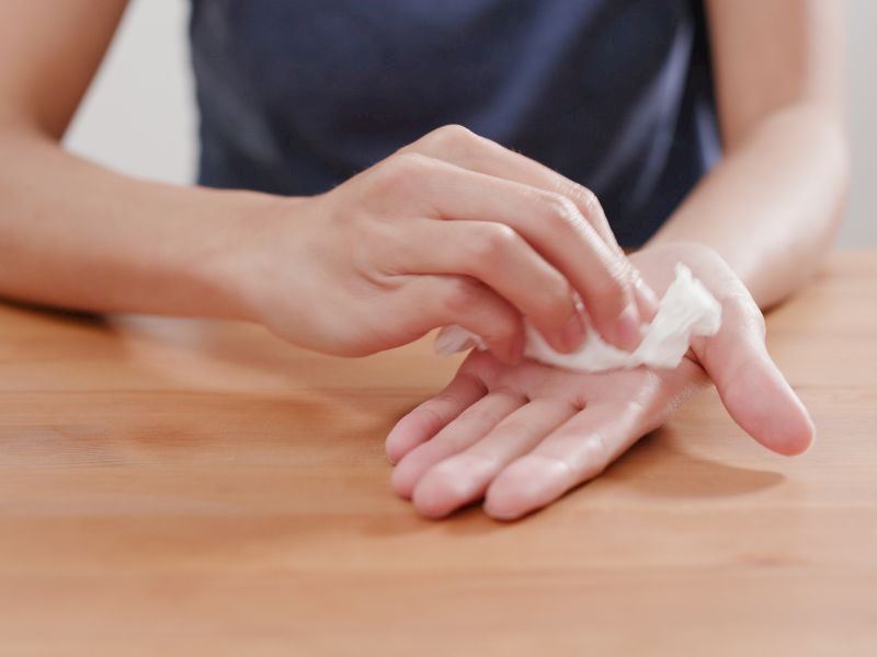 El Terlemesine Ne İyi Gelir: 4 Doğal Çözüm