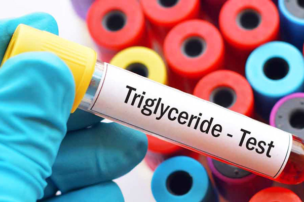 trigliserid yüksekliği