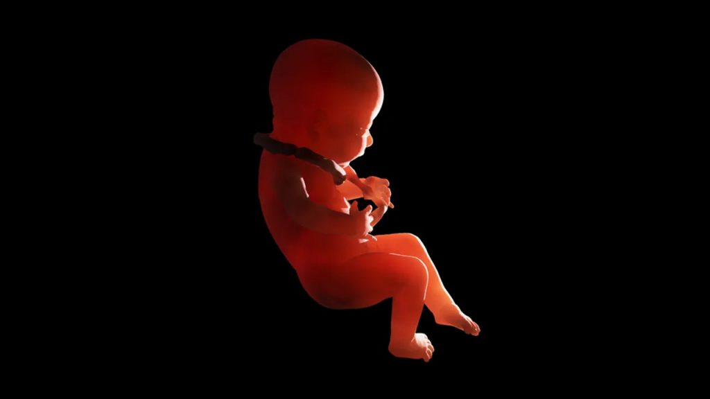 Nadir fetus-in-fetu vakası… – CHIP Online