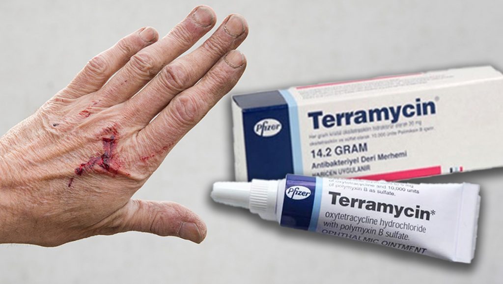 Teramisin (terramycin) nedir, neye yarar? Yanık ve yara izlerine iyi gelir mi?
