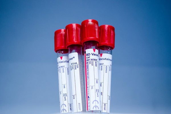 c vitamini eksikliği