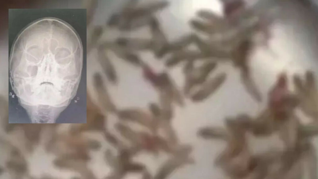 Belirtileri ciddiye almadı, hastanede gördükleri karşısında şoke oldu
